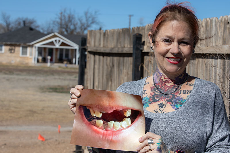 patient holding up before and after photos of themself