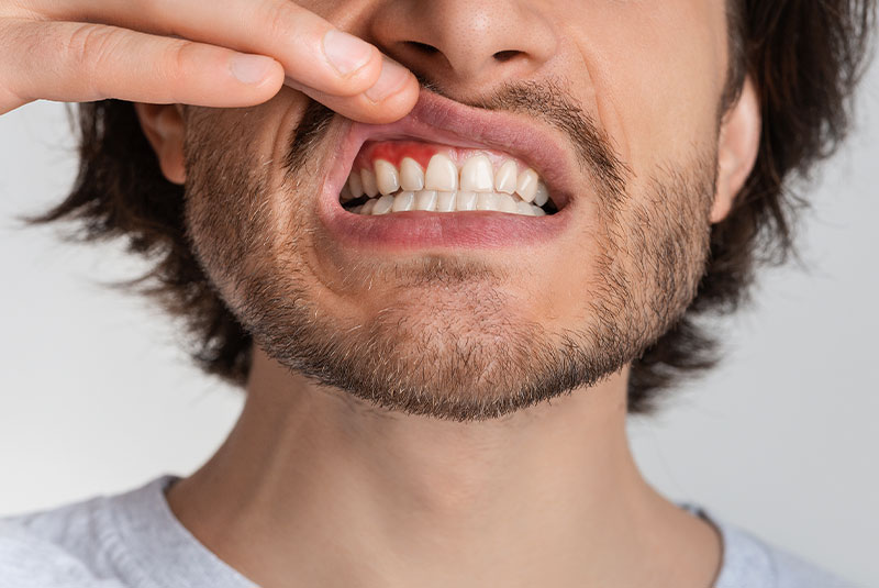 gum disease