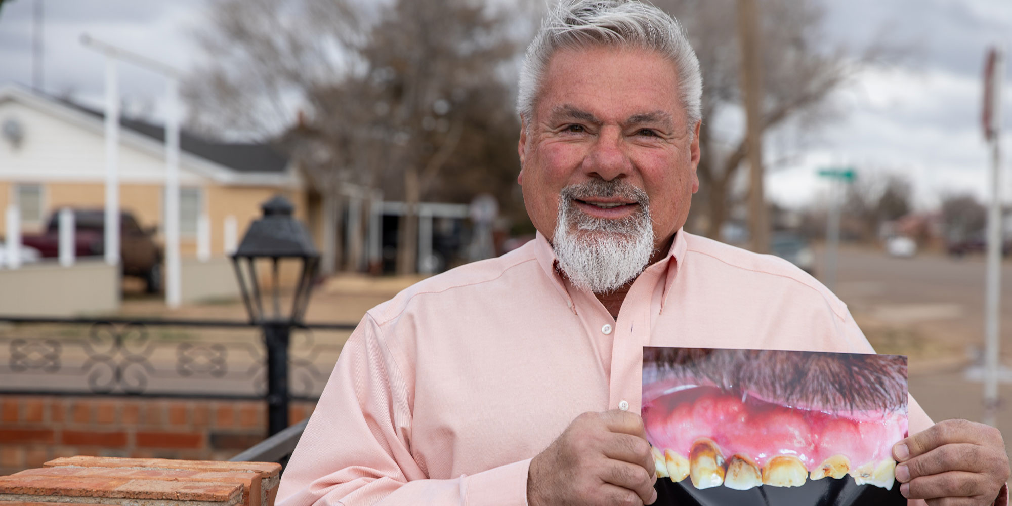patient holding up a before photo of their teeth