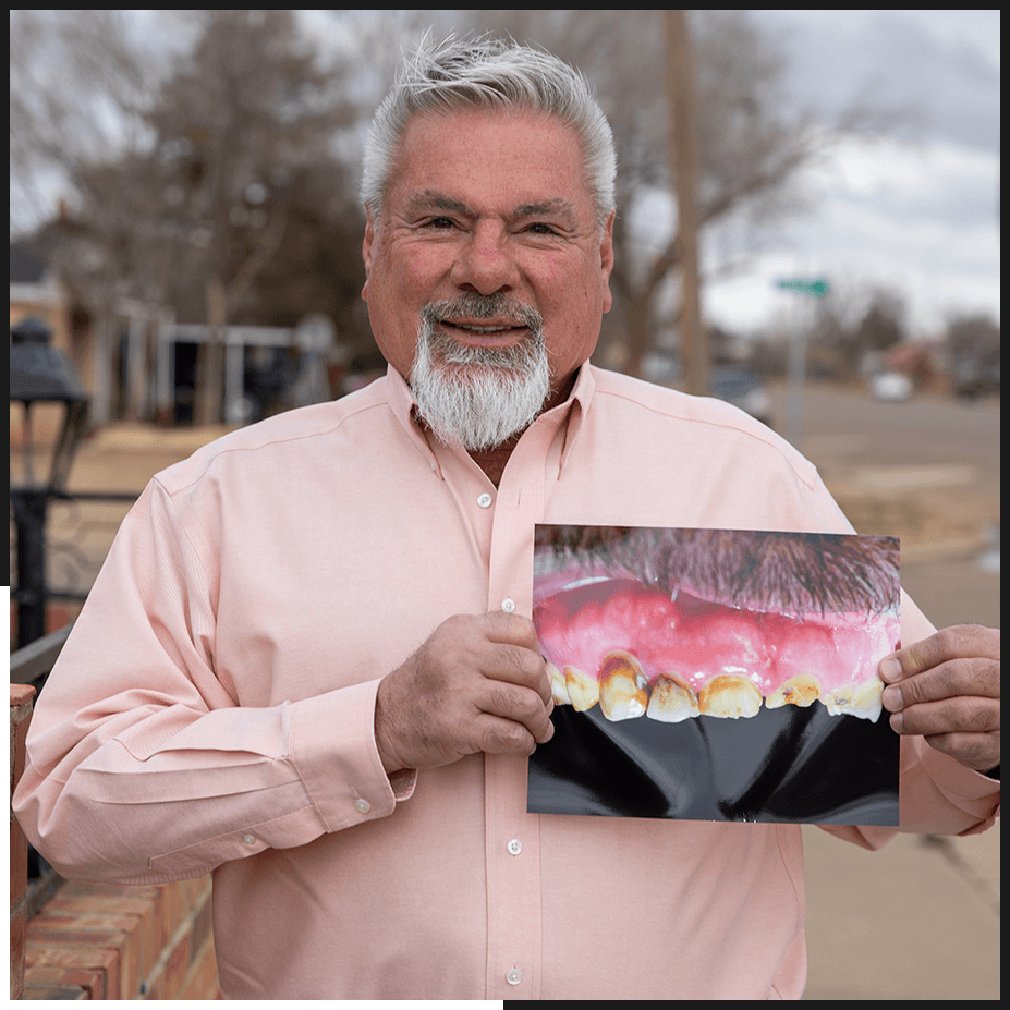 dental implant candidate