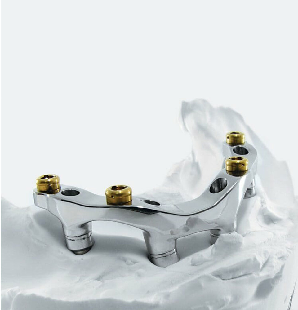 Titanium Frame