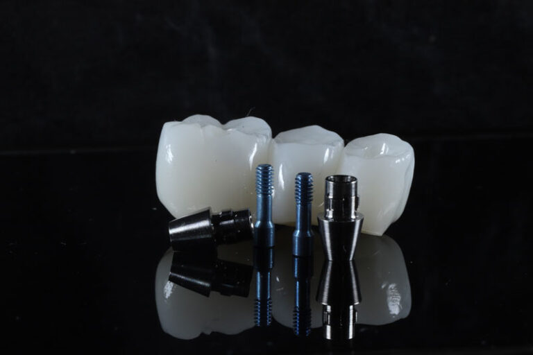 a dental bridge with holes for implants to be placed into them