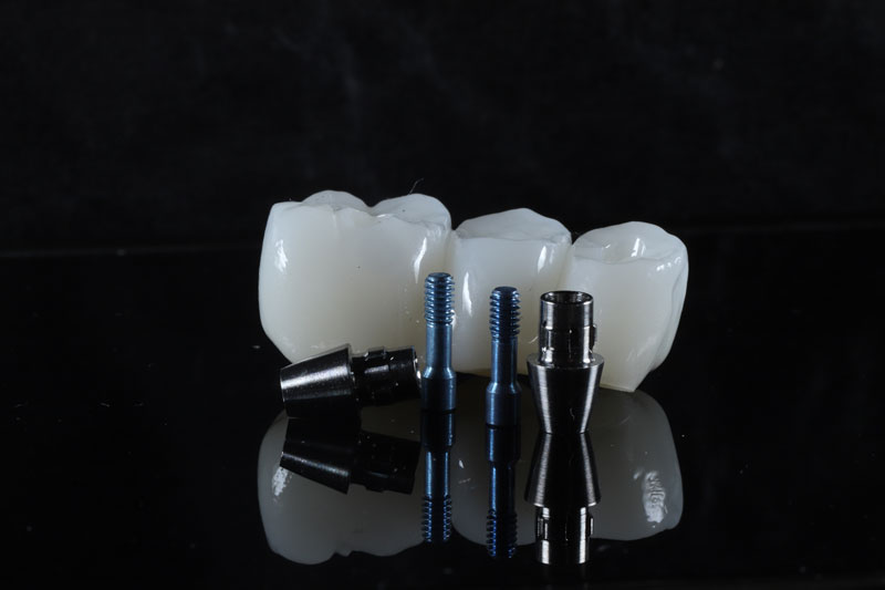 a dental bridge with holes for implants to be placed into them