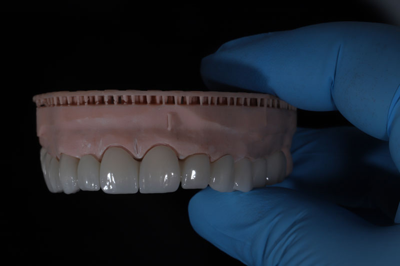 a full arch of teeth