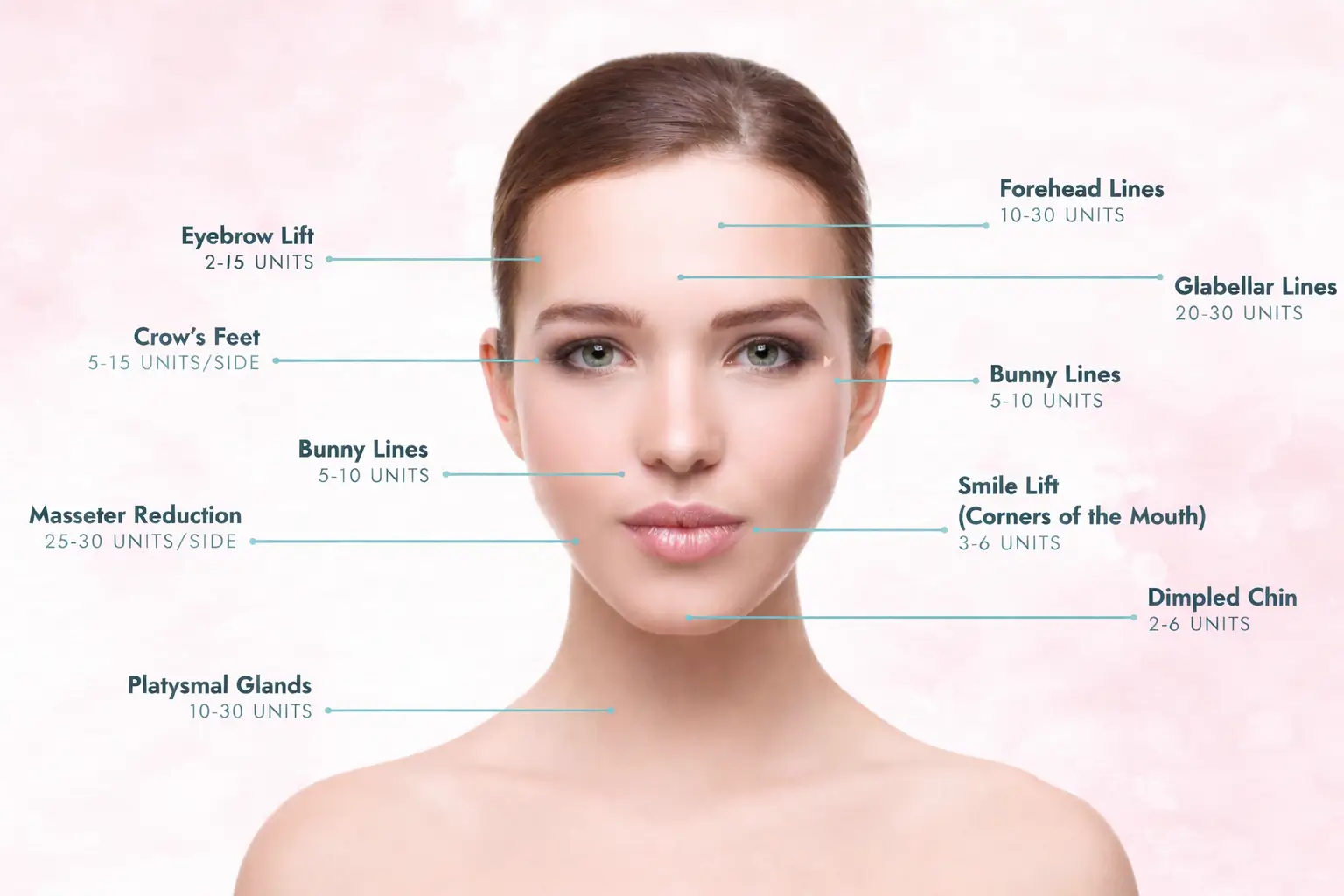 Botox Diagram